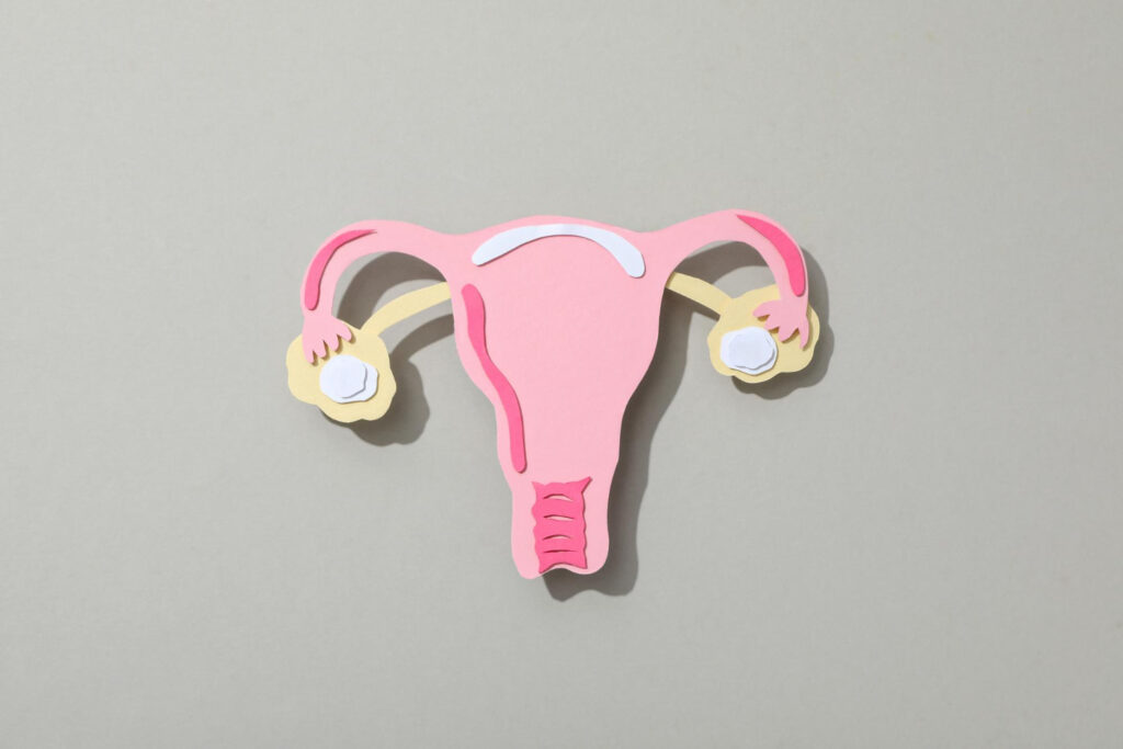 자궁내 장치(IUD) 삽입 위치 설명 일러스트